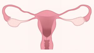 Papillomavirus et cancer du col de l'utérus