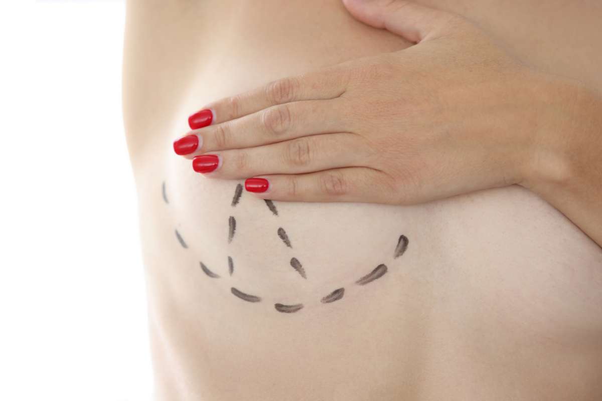 augmentation mammaire femmes seins